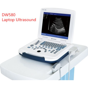 preço do portátil echographe &amp; xuzhou DAWEI portátil ultra-som